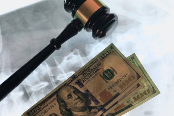 Why CPAP Lawsuits Hinge on Proof of Defect, Not Just Sickness